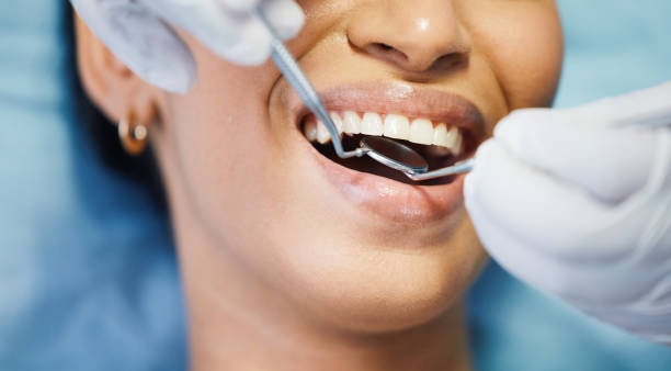 Best Emergency Dentist for Special Needs Patients in Cambria, IL